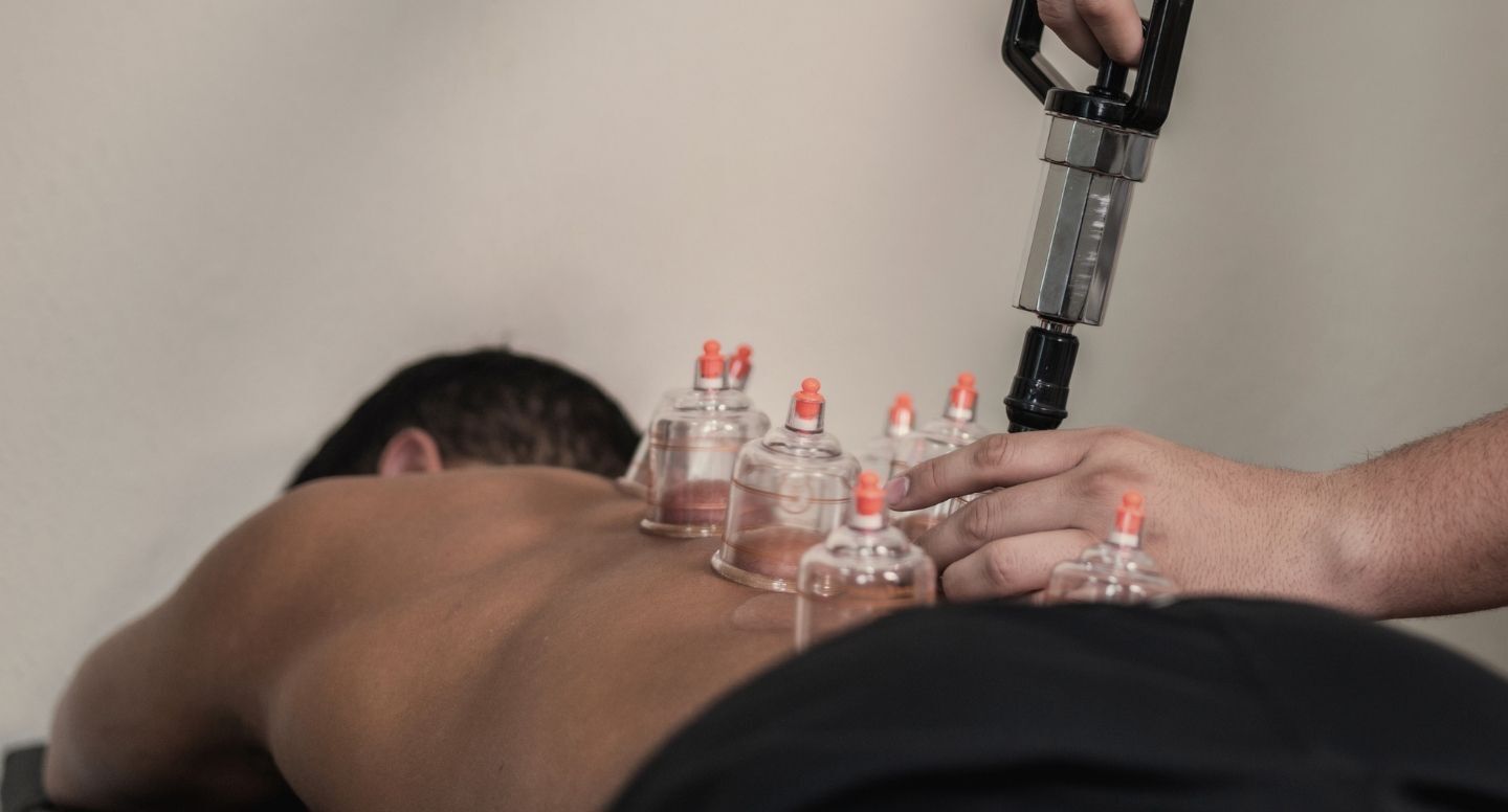 Aquagranda Massaggi - Coppettazione Sportiva